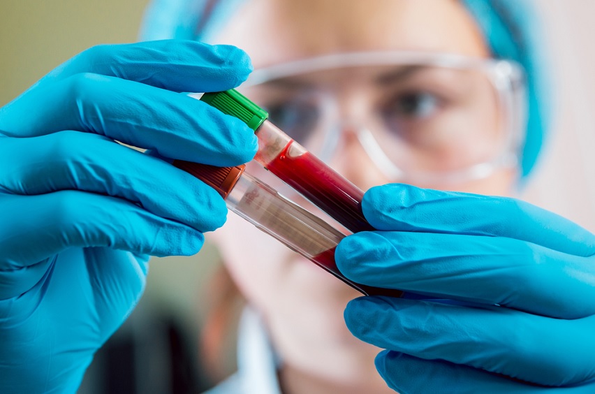 Exame de sangue pode ajudar a diagnosticar transtornos mentais
